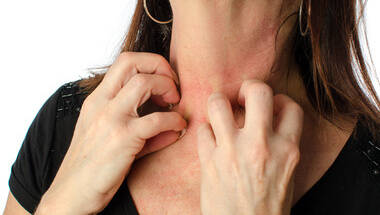 Comment prevenir l'eczema ?