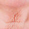 Close-up of a person's neck showing prominent wrinkles and creases in the skin.
