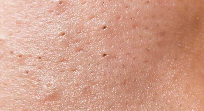 Close-up of skin texture showing small pores and a smooth surface.