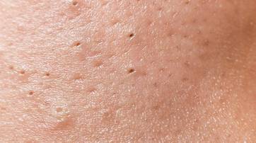 Close-up of skin texture showing small pores and a smooth surface.