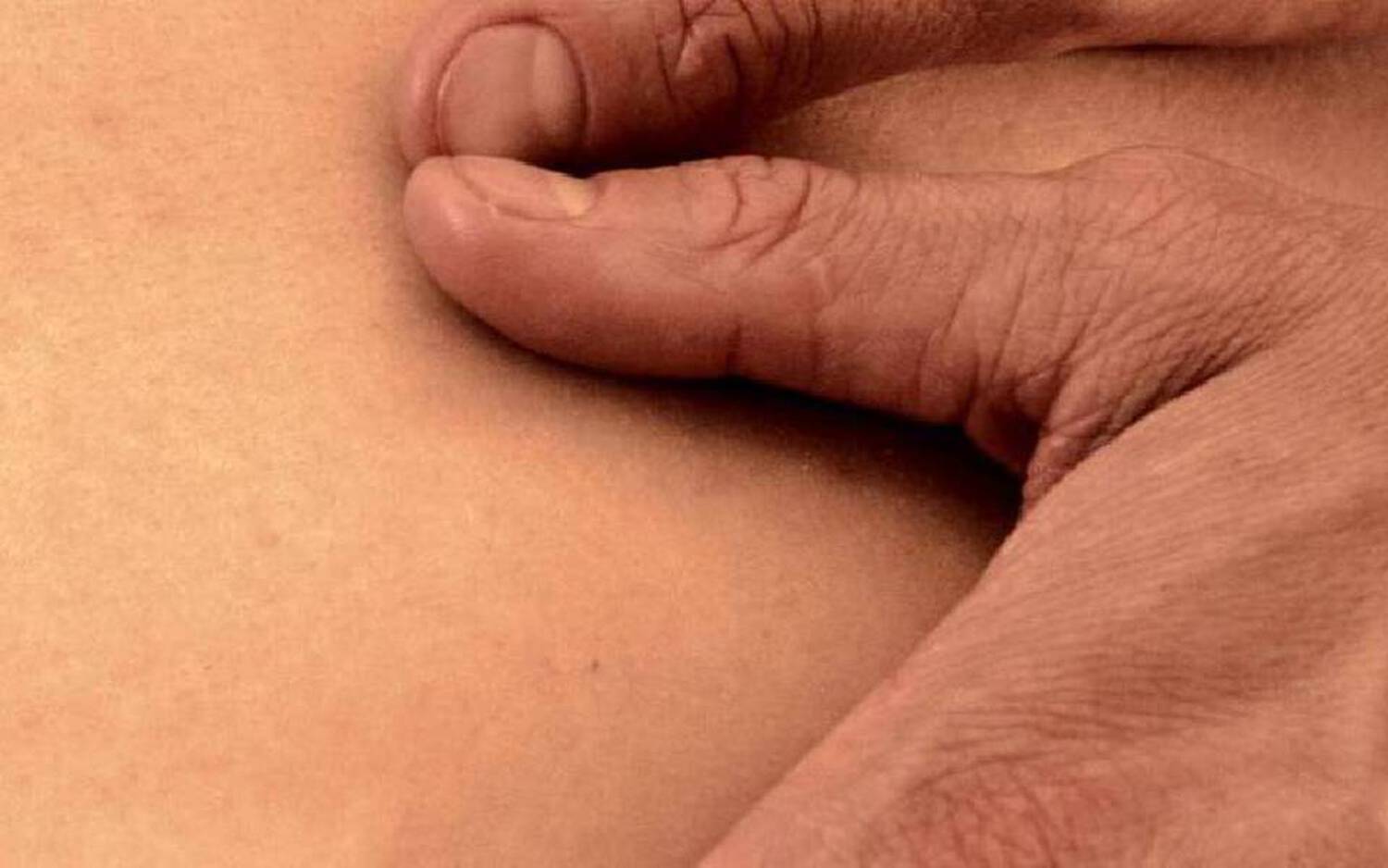 Un gros plan de la peau montrant une cicatrice, avec une main qui touche doucement la zone.