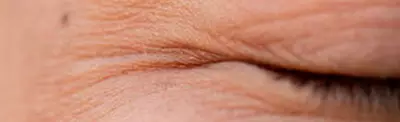 Close-up of a closed eyelid with fine lines and wrinkles.