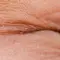 Close-up of a closed eyelid with fine lines and wrinkles.