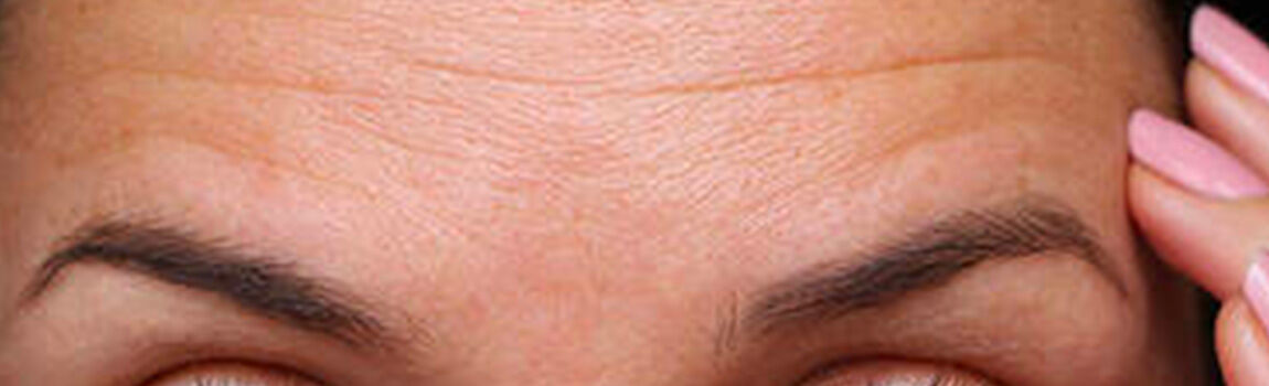 Close-up of a person's forehead, showing fine lines and smooth skin around the eyebrows and eyes.