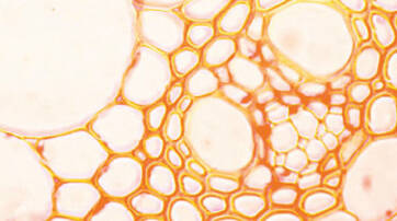 Microscopic view of a web-like structure with interconnected cells and large hollow spaces, resembling a pattern of bubbles or honeycomb. The colors are predominantly orange and pale.