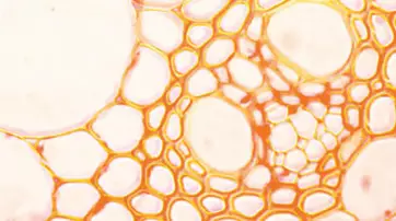 Microscopic view of a web-like structure with interconnected cells and large hollow spaces, resembling a pattern of bubbles or honeycomb. The colors are predominantly orange and pale.