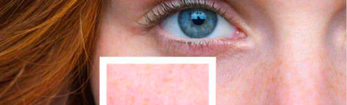 A close-up of a person's eye with striking blue irises and long eyelashes, accompanied by an inset showing a section of skin texture with a smooth, pinkish tone.