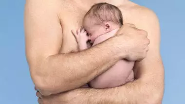Qu'est-ce que l'eczema ?