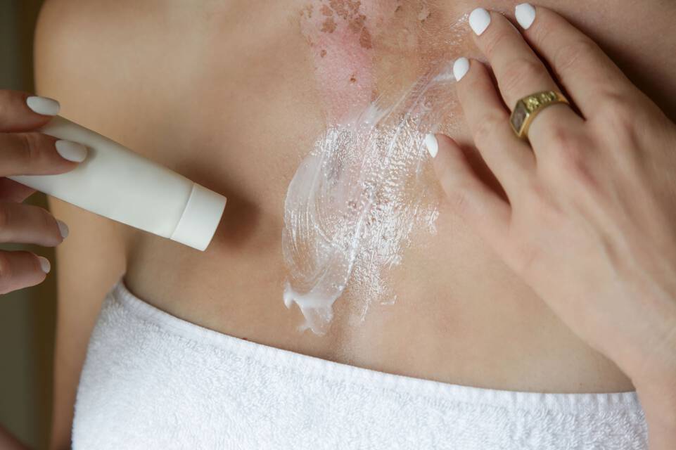 Creme solaire : pourquoi aide-t-elle a lutter contre le vieillissement de la peau ?