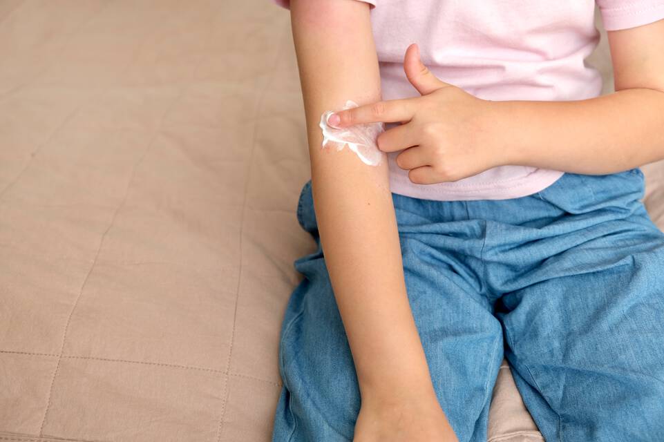 Causes de l’eczema