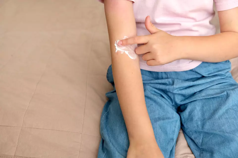 Causes de l’eczema