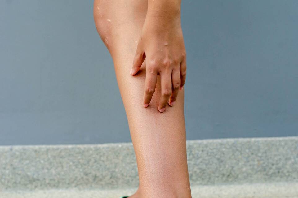 Eczéma des jambes : causes, symptômes et solutions | La Roche-Posay