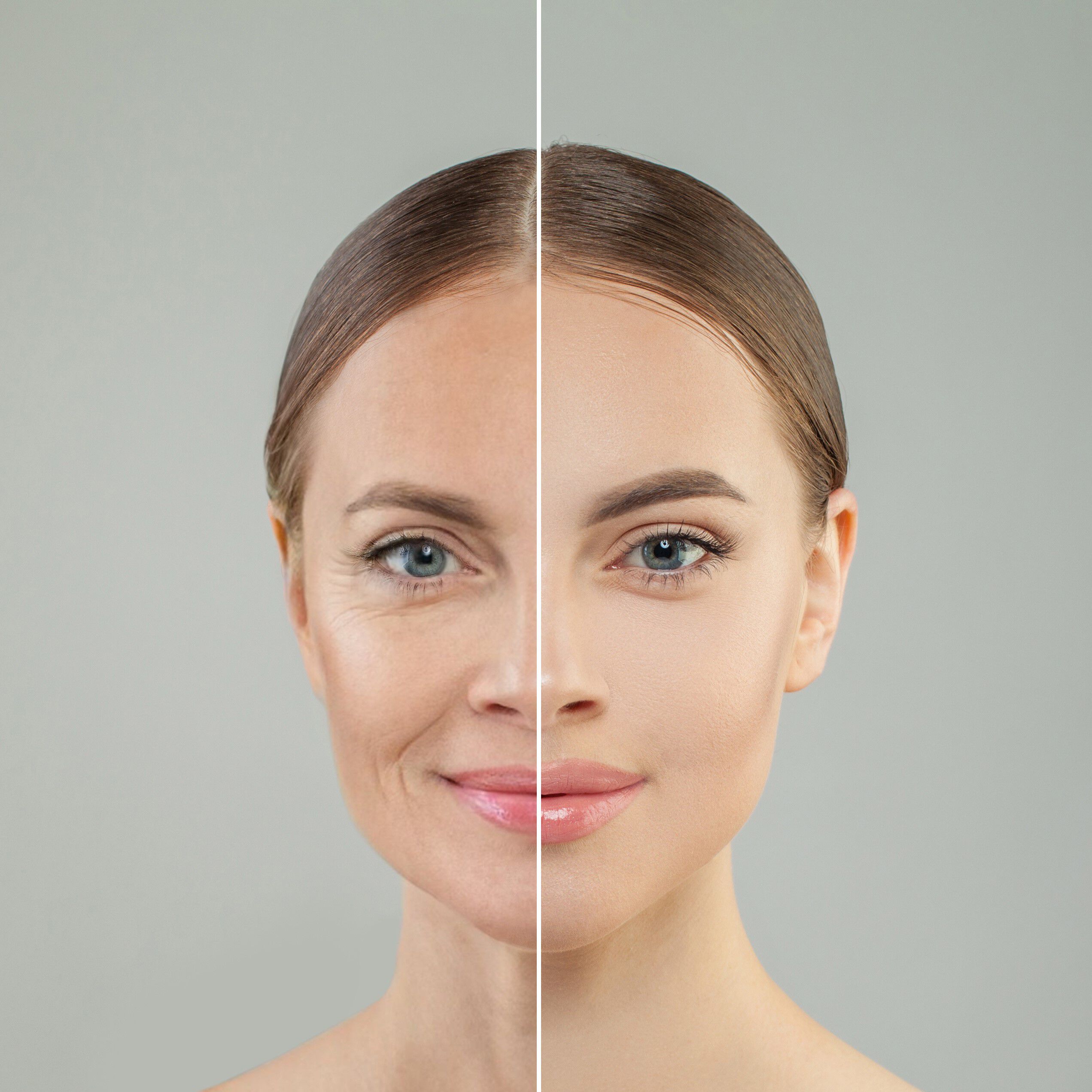 Eczema de contact