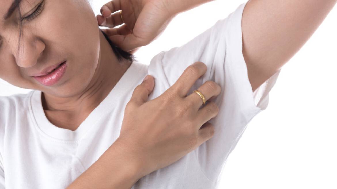 Eczema des mains et des coudes
