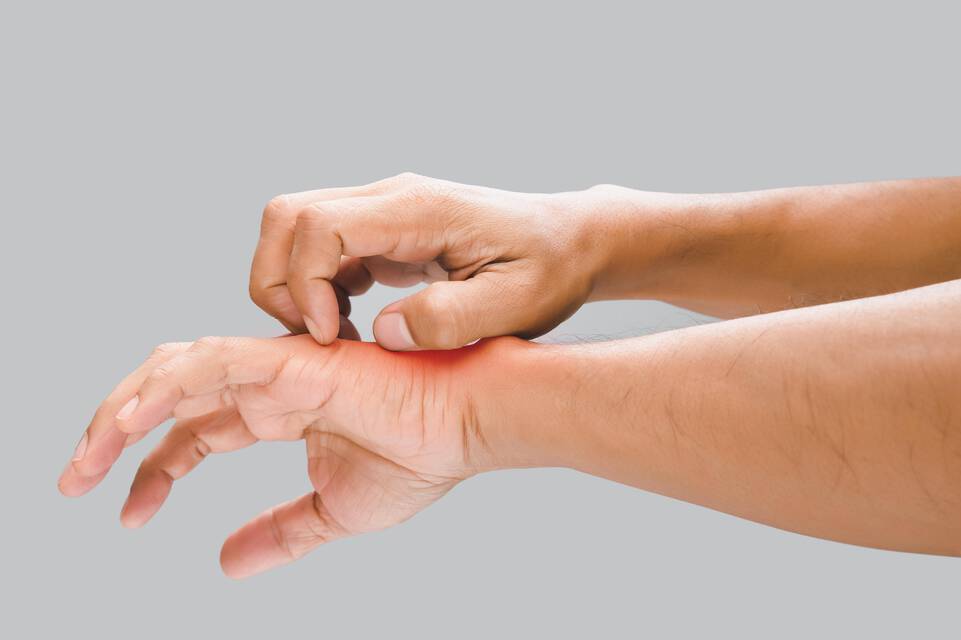Causes de l’eczema