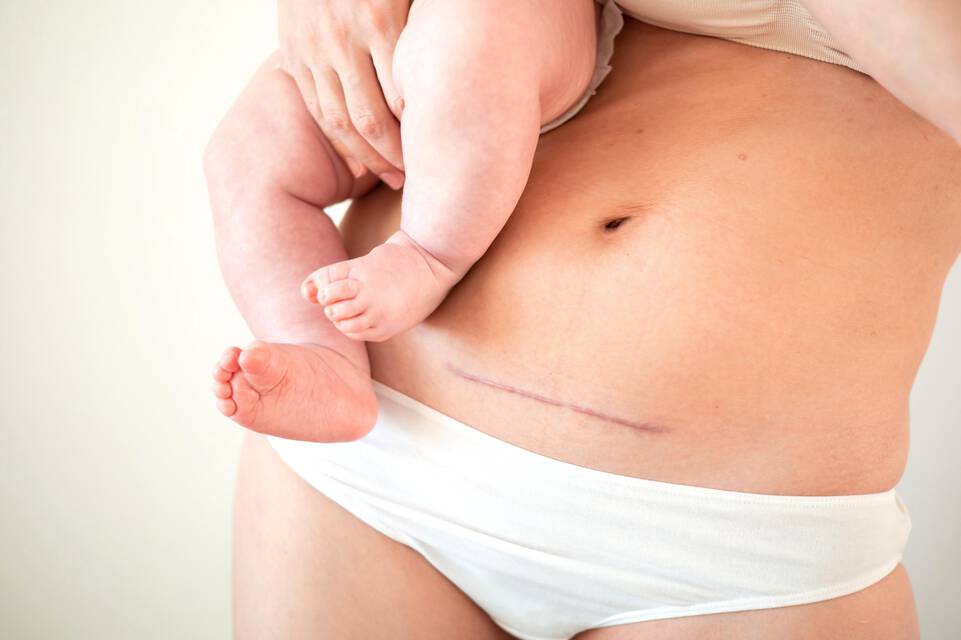 Causes de l’eczema
