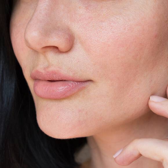 Eczema atopique et eczema chronique des mains