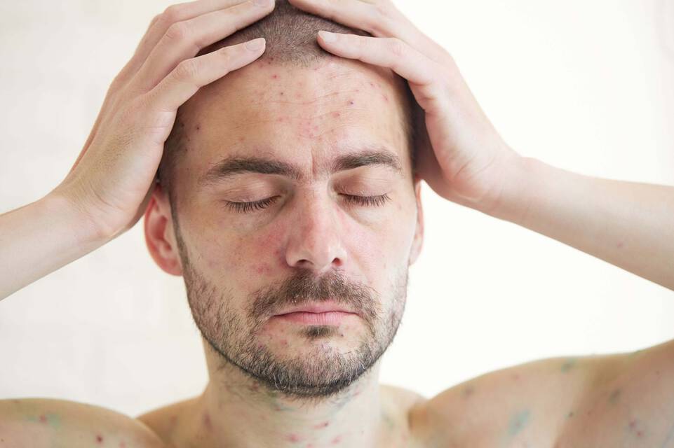 Creme solaire : pourquoi aide-t-elle a lutter contre le vieillissement de la peau ?