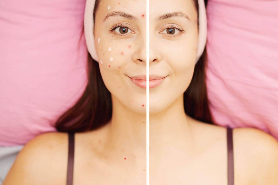 Creme solaire : pourquoi aide-t-elle a lutter contre le vieillissement de la peau ?