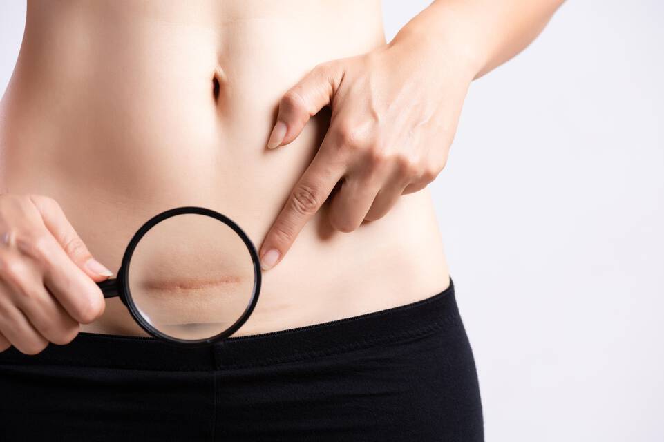 Causes de l’eczema