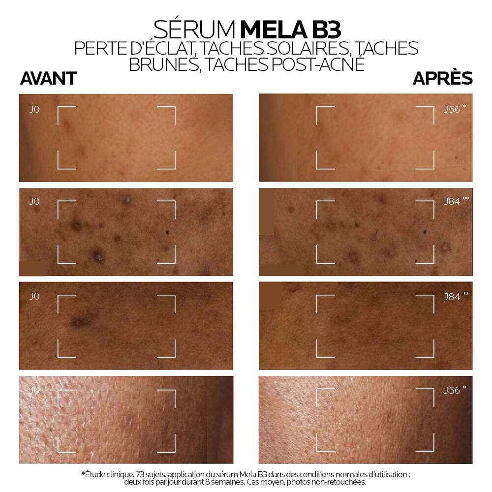 Mela B3 Serum anti-taches concentre intensif