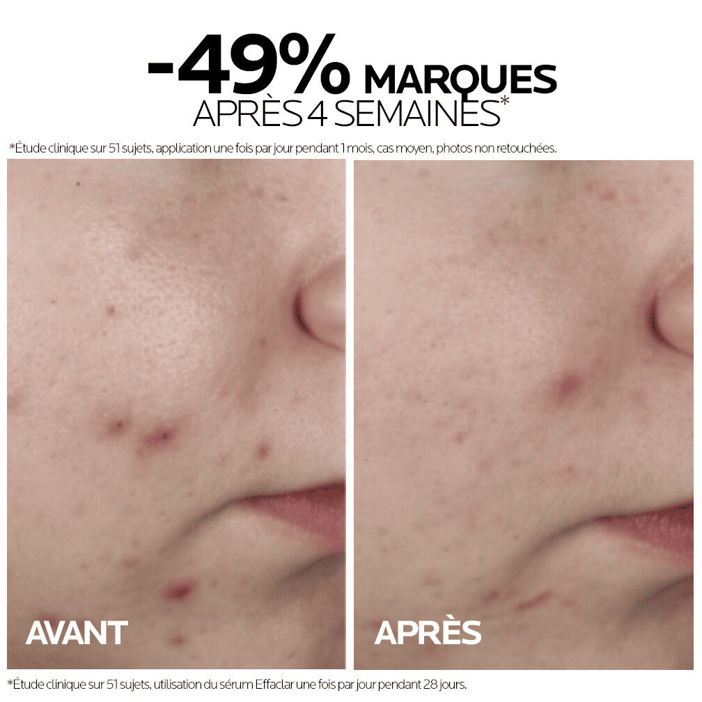 EFFACLAR Serum a l'Acide Salicylique Ultra Concentre